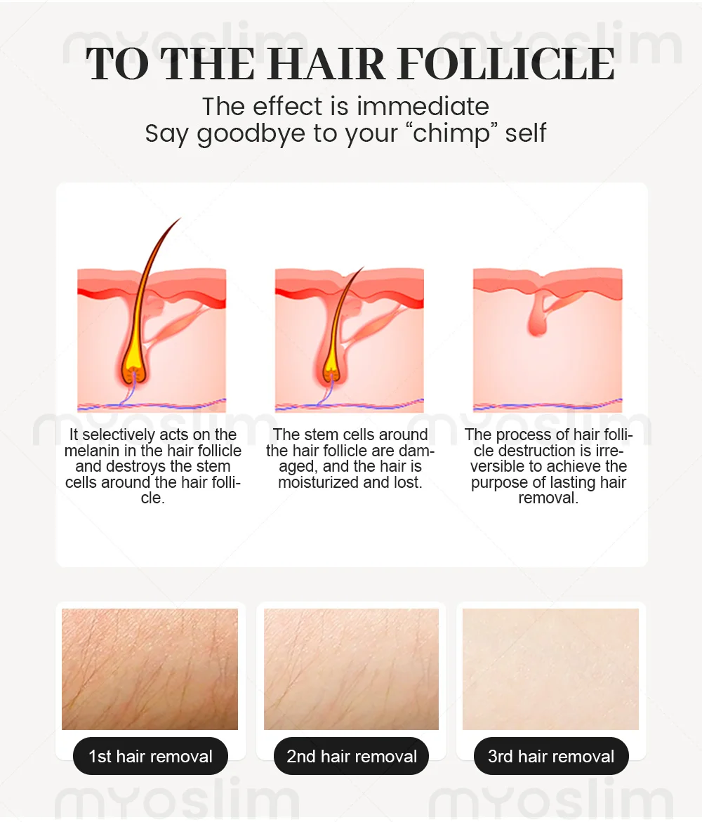 

Portable 808nm Diode Advanced Laser Beauty Device Permanent Hair Reduction CE Certification for Beauty Salon