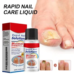 1/2/5pcs Nail Care Essence-Liquid Repairing Yellowing And Thickening Gray Nails Of Hands And Feet Nail Moisturizing Liquid 20ml