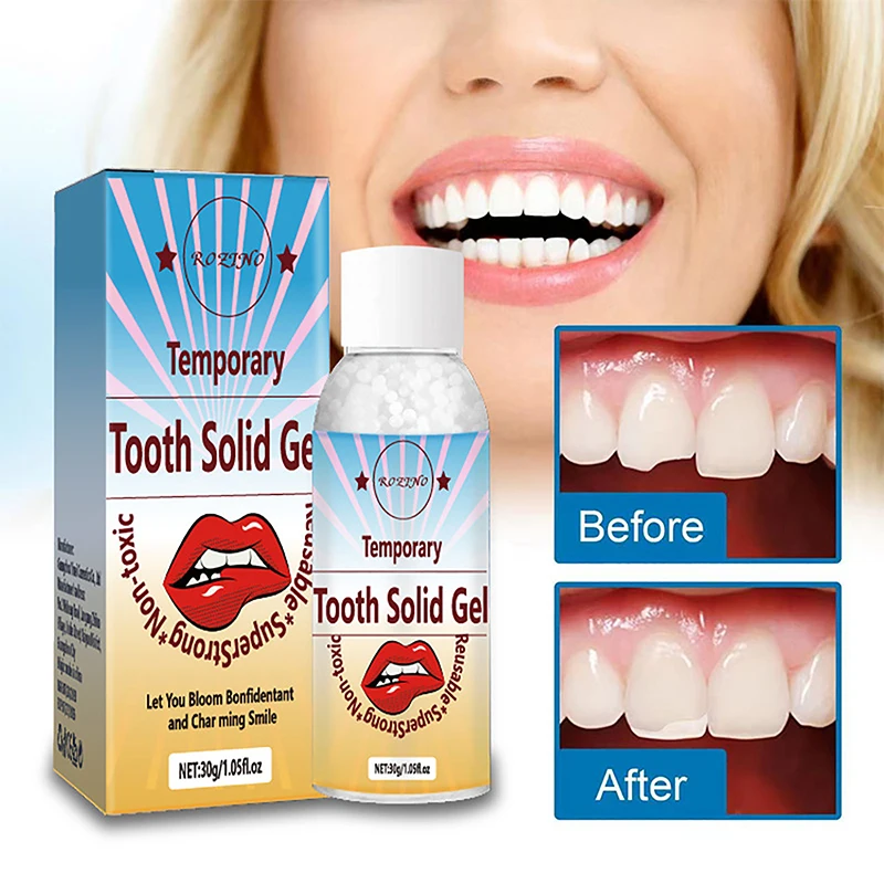 

Solid Teething Gum Temporary Tooth Kit Repair Teeth Gaps Filling False Teeth Solid Glue Denture Adhesive Beauty Teeth Whitening