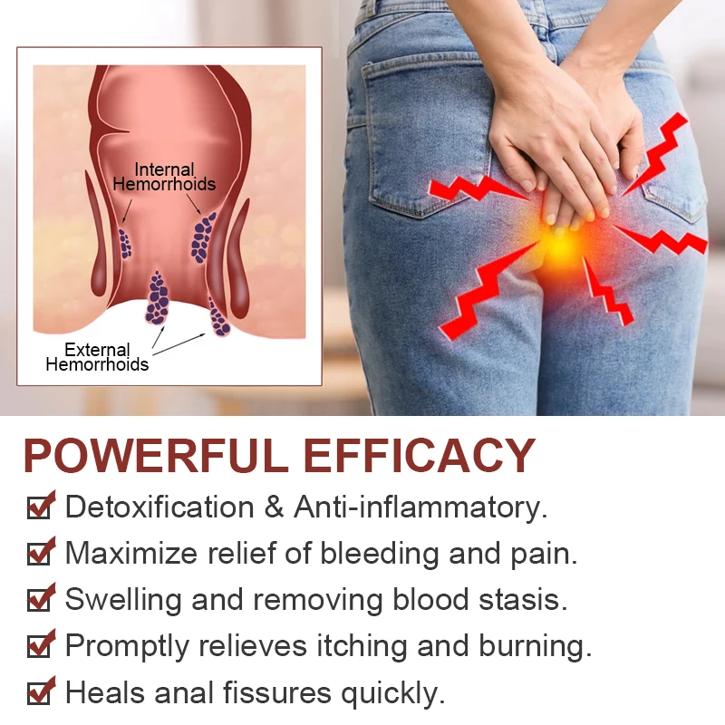 1 шт. китайская травяная мазь от геморроя, снимает анальную боль, опускает кровообращение, лечит внутренним и внешним геморроем, медицинский
