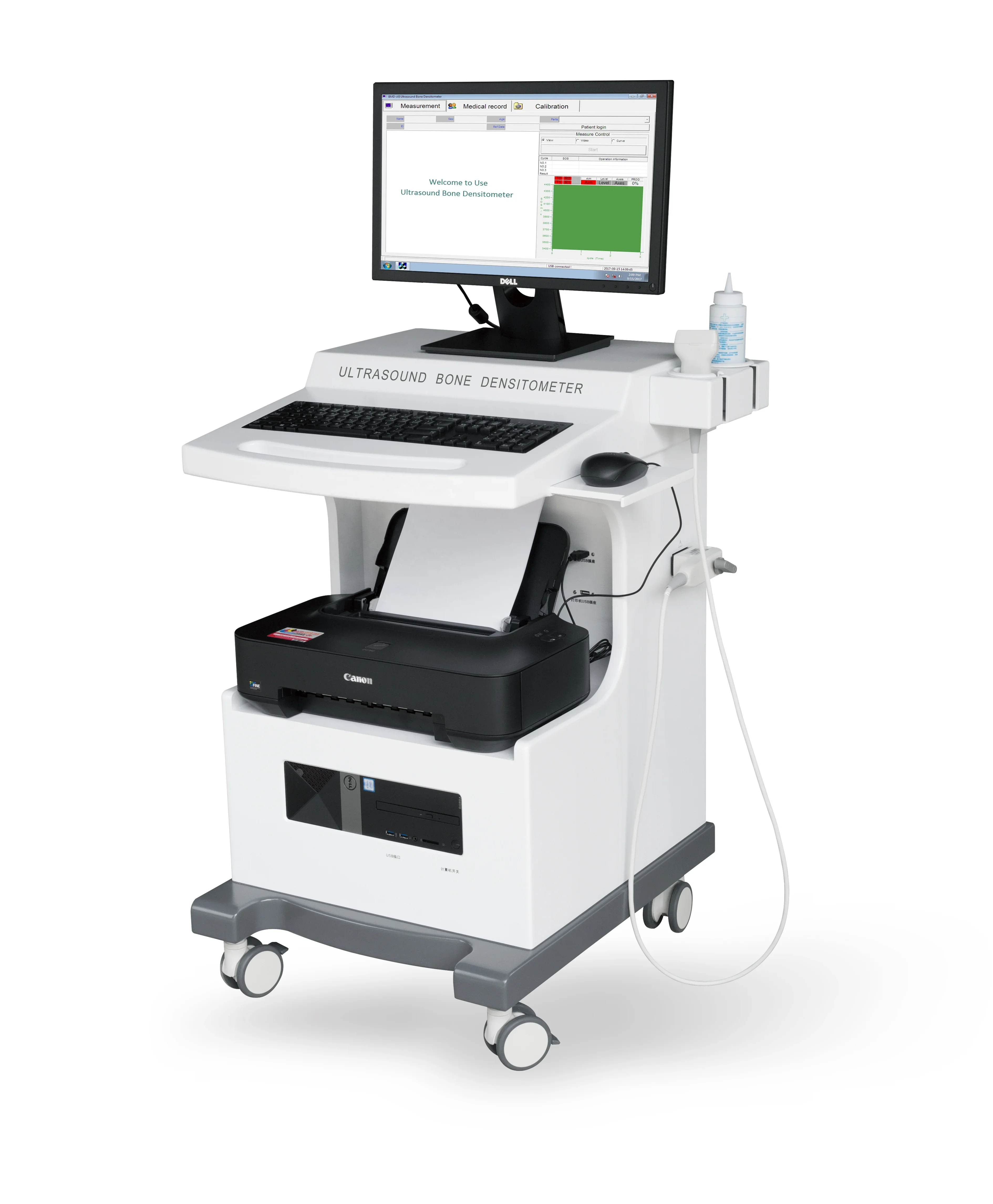 Automatic High Effective Ultrasound Bone Densitometer Trolley