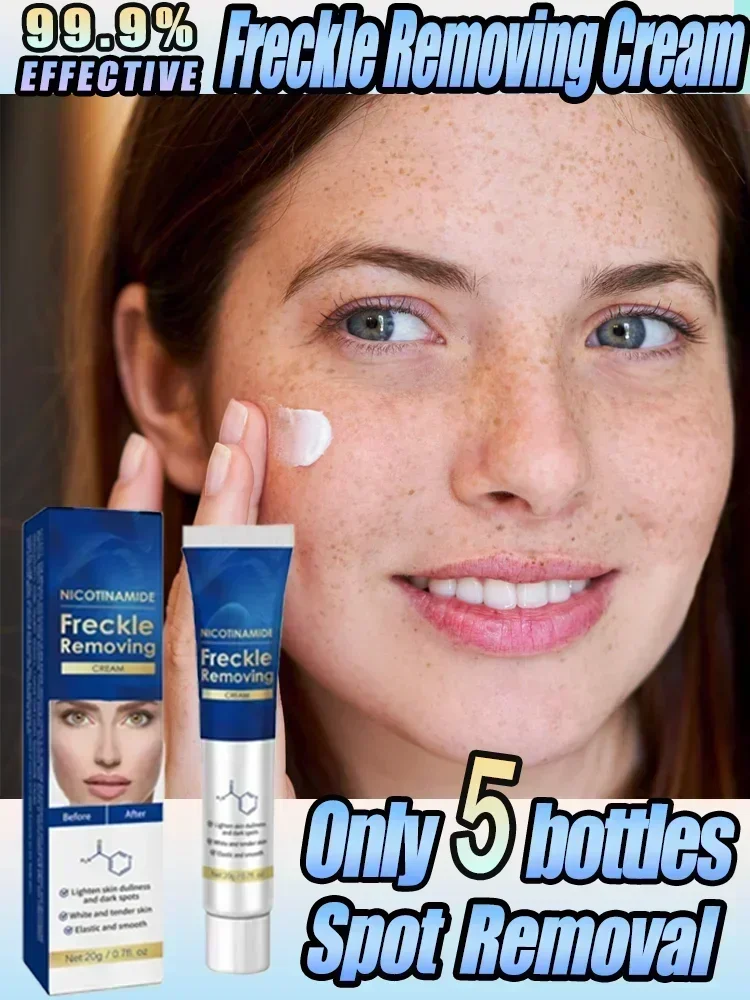 

Whitening Anti-Freckle Cream Brighten Skin Tone Remove Freckles Lighten Spots Chloasma Brighten Moisturize Face Skin Care