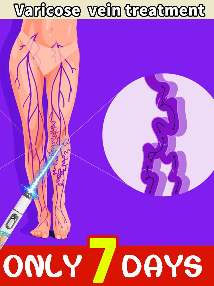 

Mini varicose vein blue light device: Painless leg care