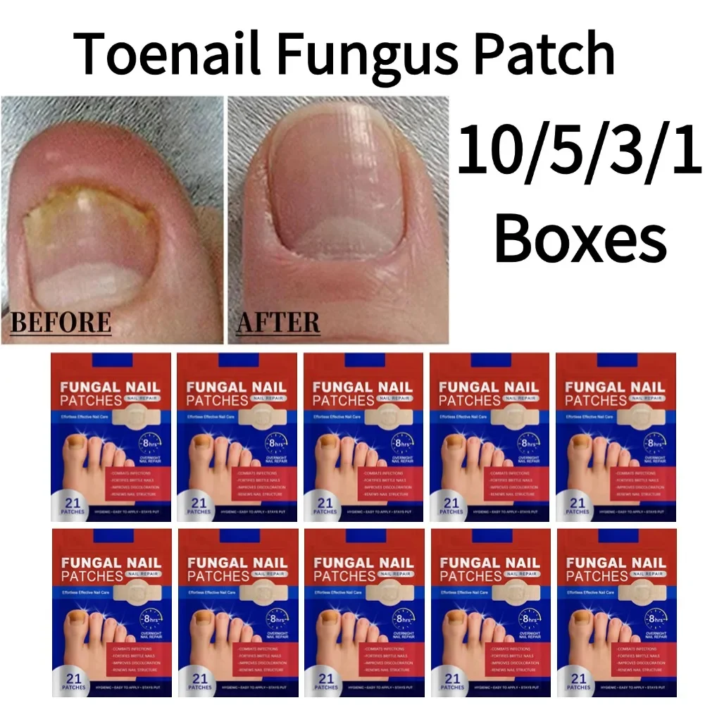 

10/5/3/1Boxes Toenail Fungus Patch Paronychia Repair Patch Waterproof Fungus Removal Patch Ingrown Correction Sticker HealthCare