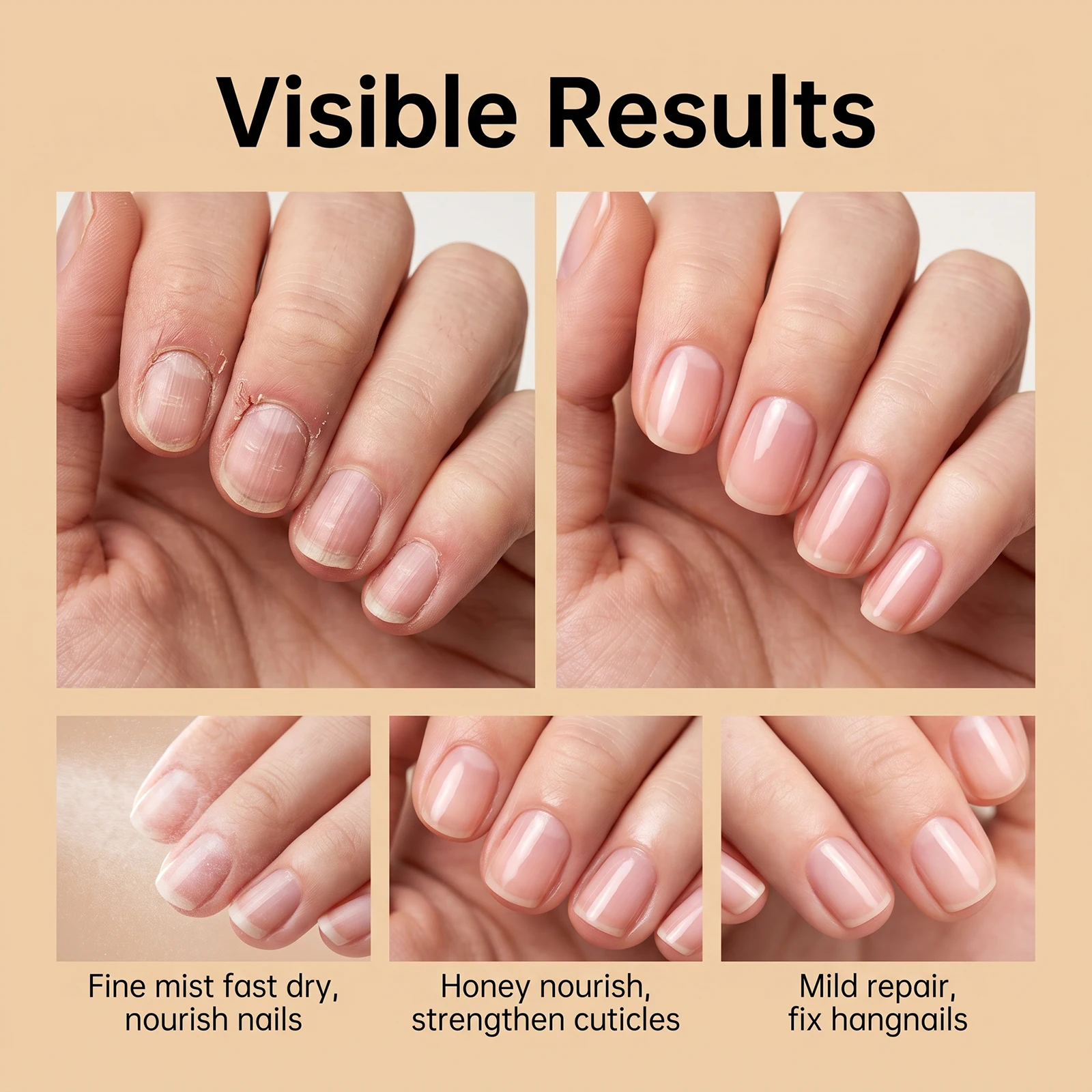 Nail Recovery Treatment Spray Healthy Repair Care For Damaged Toenails Treat Toenail Fungus And Improve Cloudy Discolored Nails