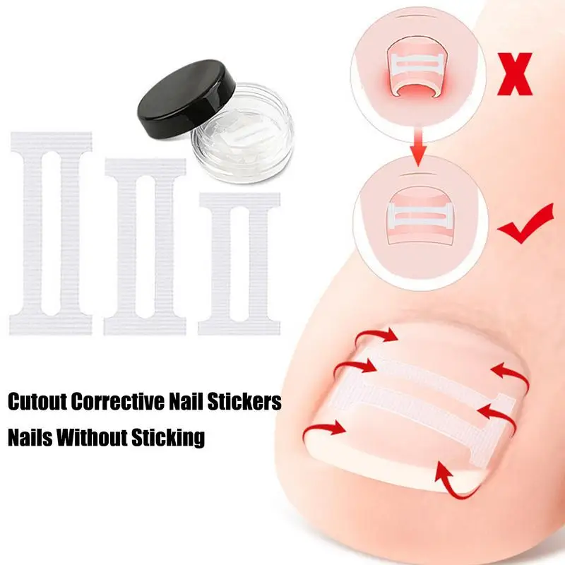 10 pçs tratamentos de unhas encravadas ferramenta de correção de unhas encravadas adesivo de remendo elástico ferramenta de correção de unhas encravadas