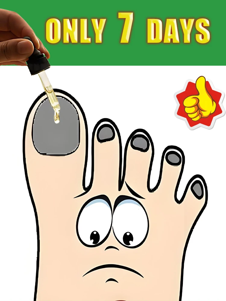 

Qᴜɪᴄᴋ Tʀᴇᴀᴛᴍᴇɴᴛ, Sᴀʏ Gᴏᴏᴅʙʏᴇ ᴛᴏ Fᴜɴɢᴀʟ Nᴀɪʟ Wᴏʀʀɪᴇs