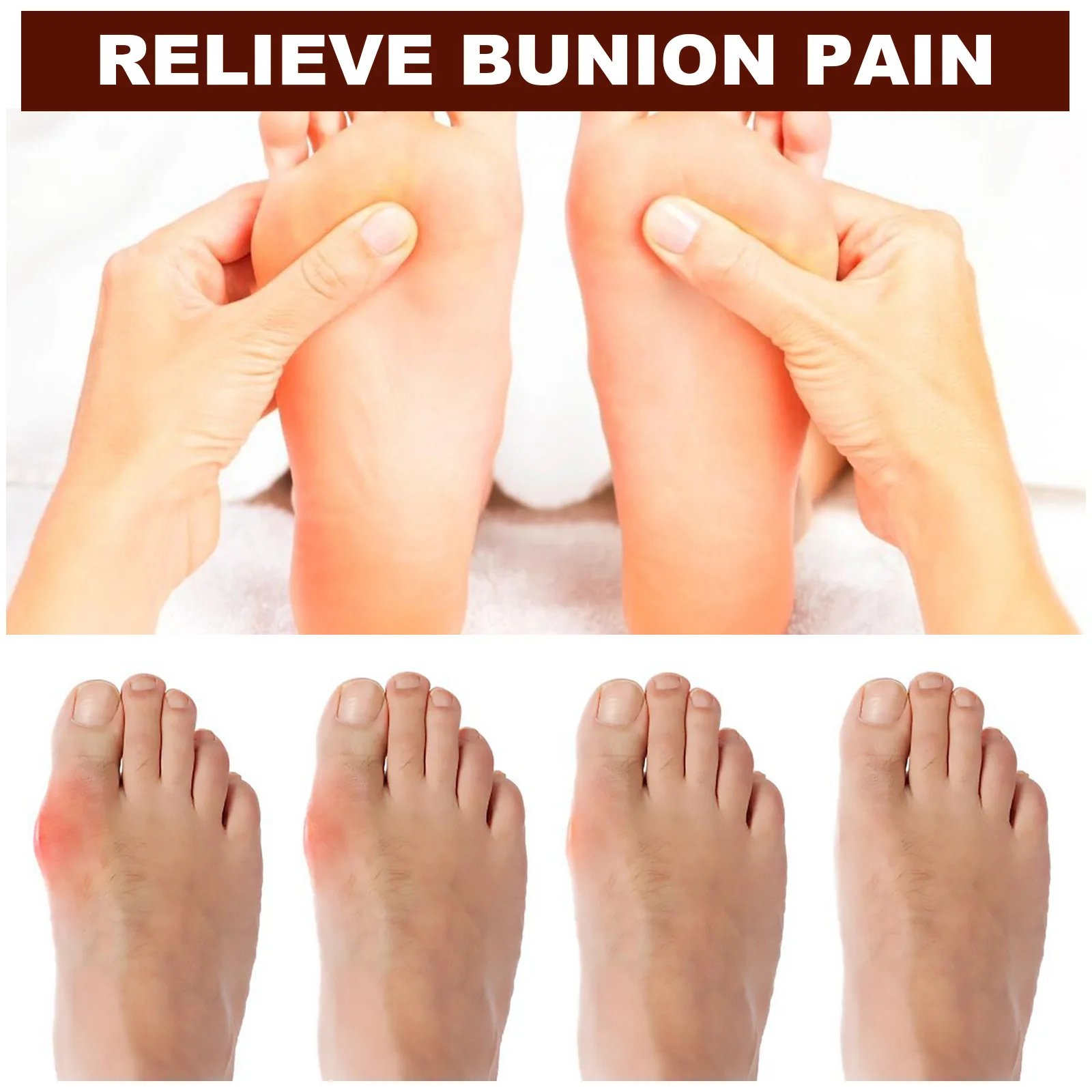 Bunion Behandlung Creme Gicht Erleichterung Gelenk Knochen Zehen Valgus Glätte isen Korrektor Orthopädie Arthritis 60ml