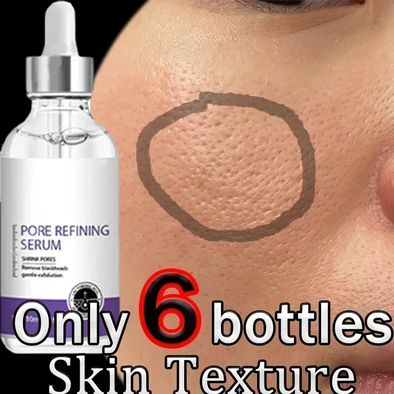 

Acid Pore Shrinking Serum Face Removing Large Pores Tightening Repairing Facial Pore Minimizing Essence Oil Firm Skin Care090437