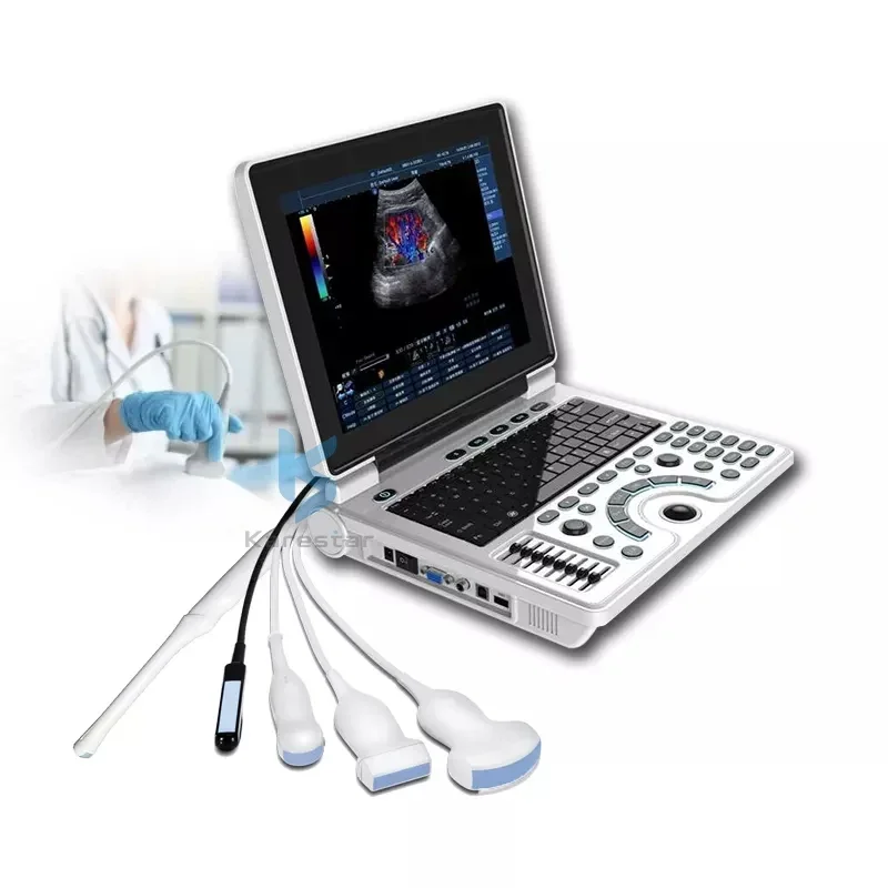 Digital Laptop Ultrasound Machine best price ultrasound Scanner