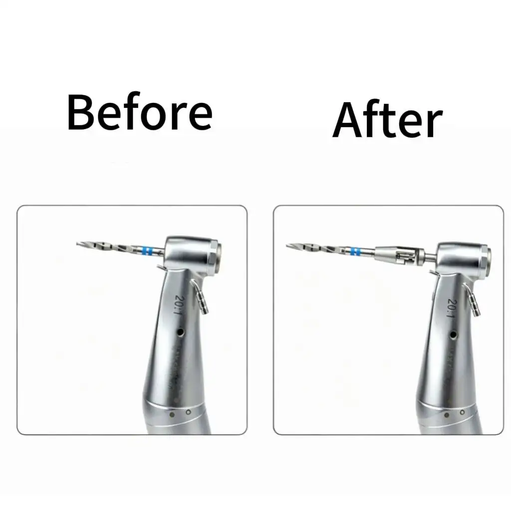Picture 3: Dental Universal Implant Extender Low Speed Planting Extension Rod Drills Bit Tool