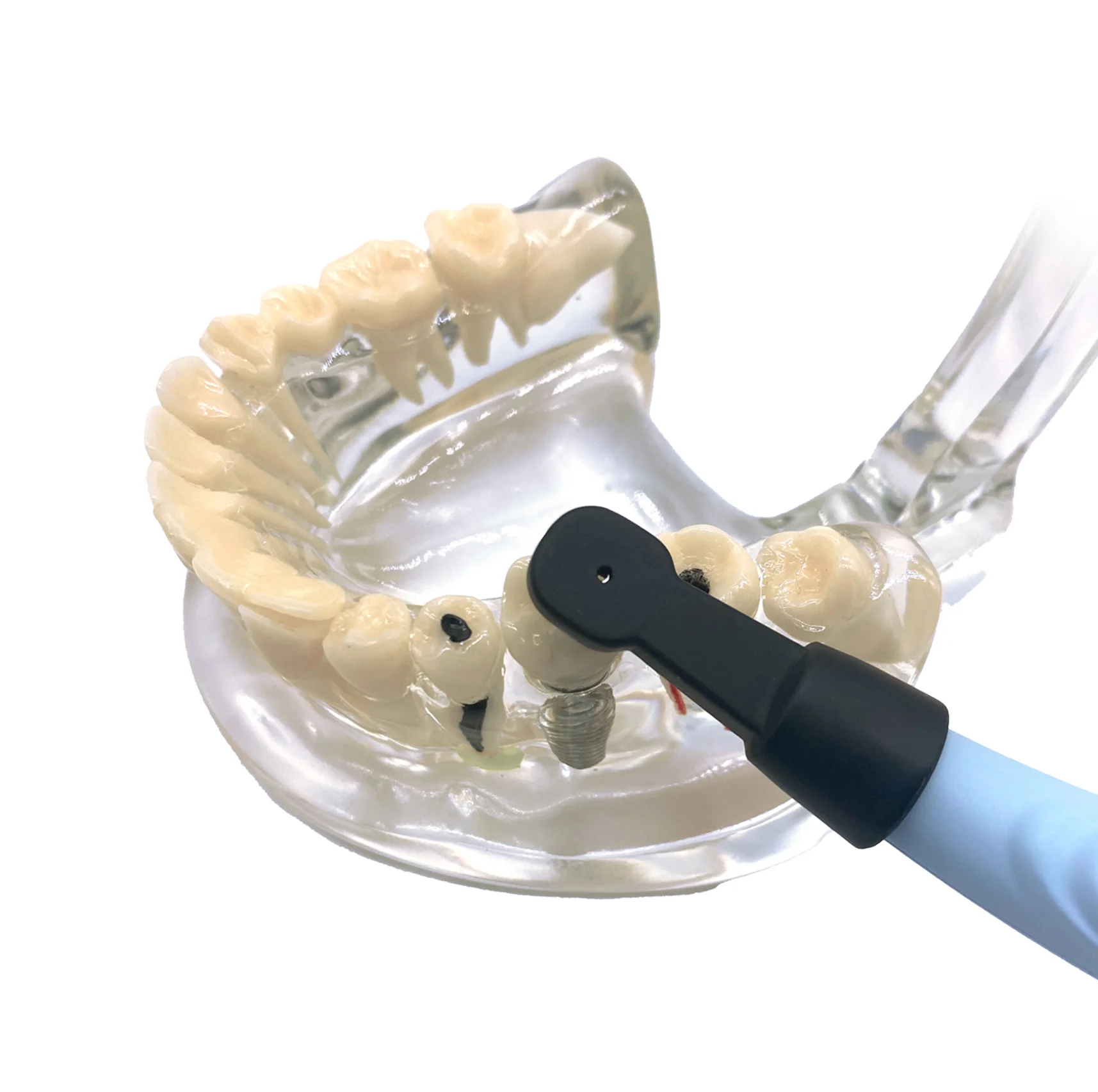 Easyinsmile Dental Implant Locator Detector Easy-Do Smart Rotatably Implant Micro Screw Abutment Finder Spotter With 3 Sensor