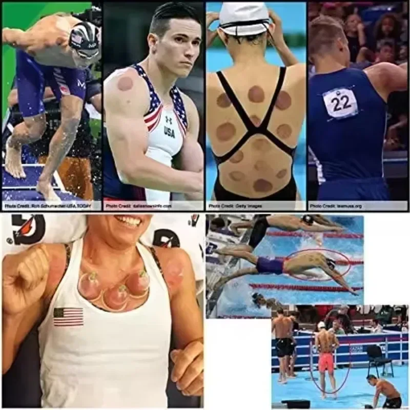 

Hot salesHot salesMassage Therapy Portable Electric Scraping Universal Cupping Kit Set Vacuum Suction Cups Homeuse Chinese CE Su