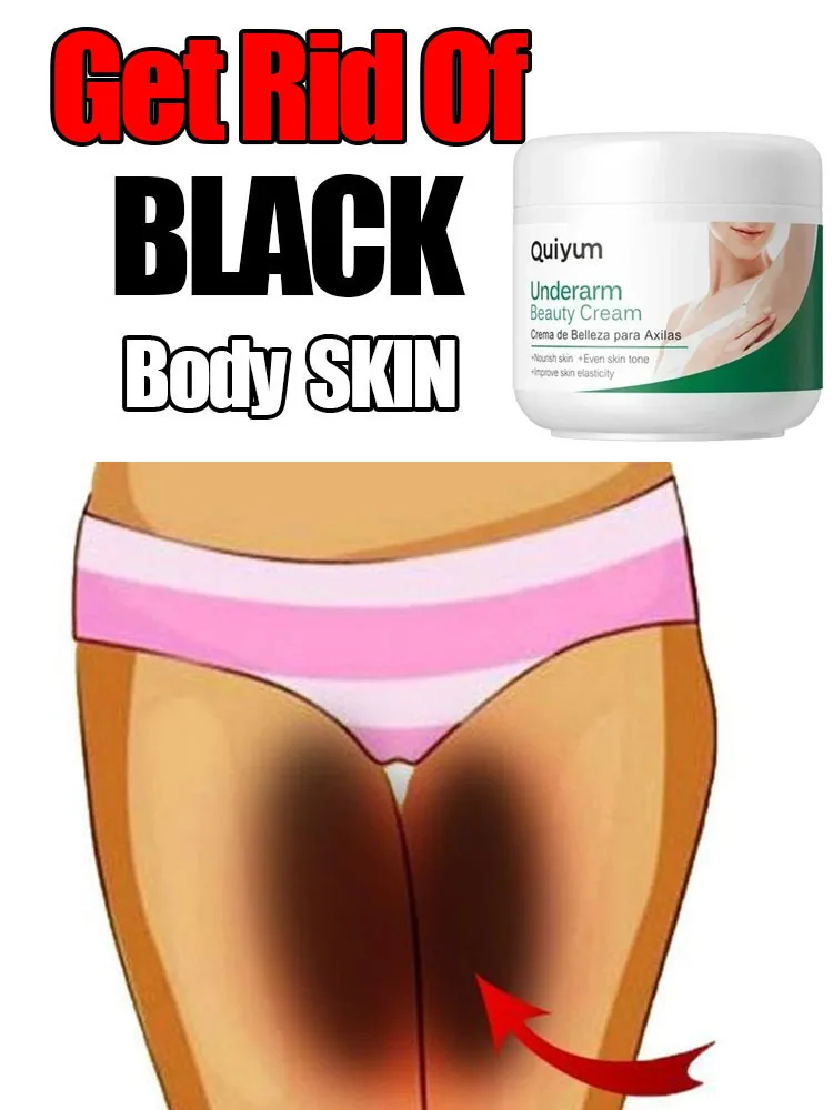 

Brighten Underarm beauty cream Armpit Legs Knee Elbow Bleaching Cream Dull Remove Dark Spots Melanin Skin Care Body Whitening