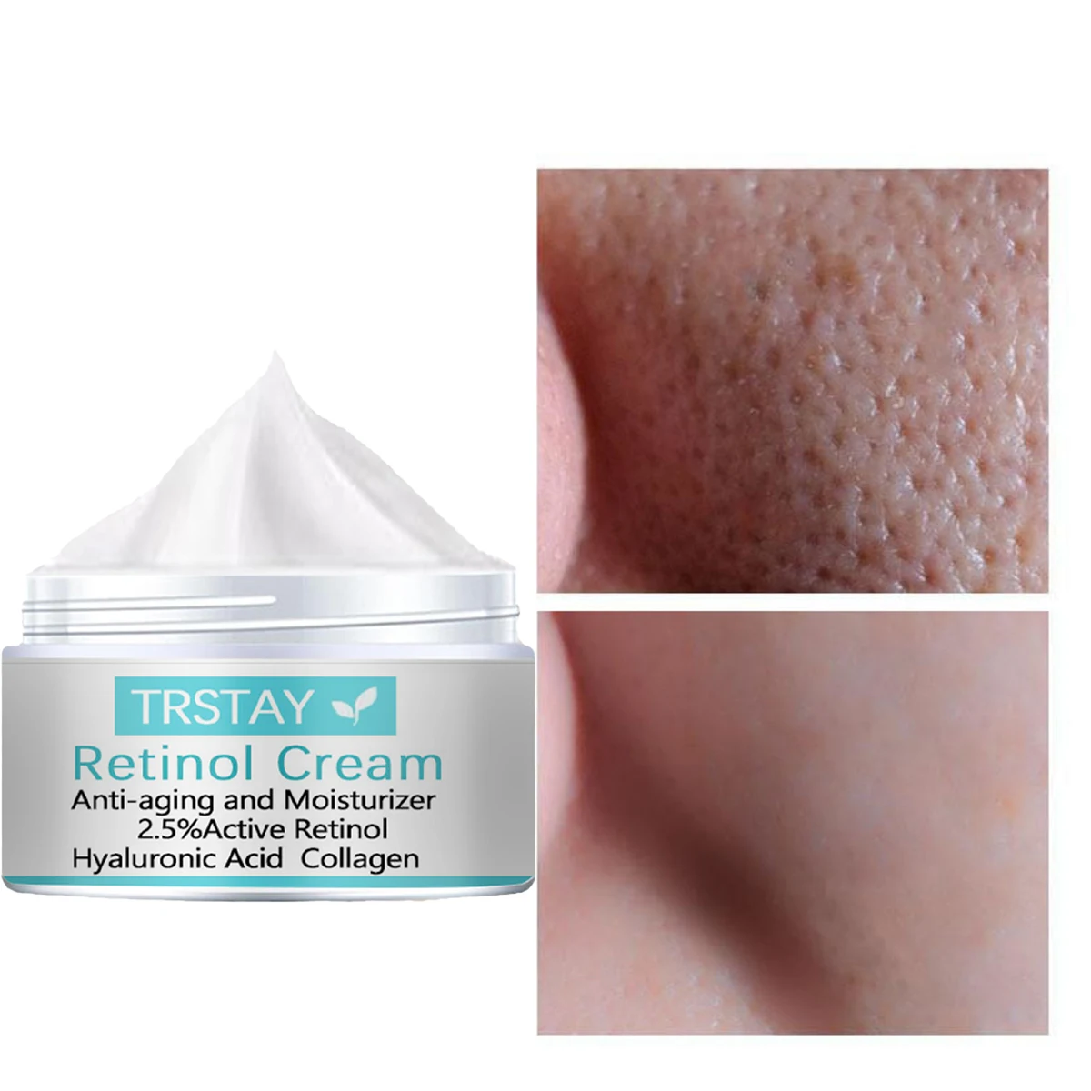 TRSTAY Brightening Cream Moisturizing Fade Melanin Skin Lotion Underarm Concealer Moisturizing