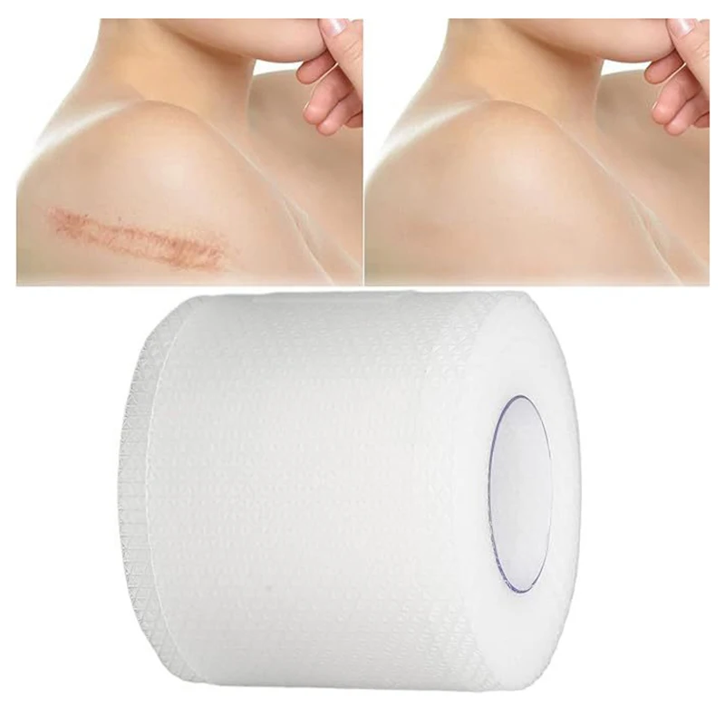 سيليكون ندبة التصحيح شفافة ندبة الشريط لفة ندبة ورقة إزالة ذاتية اللصق الشريط العلاج التصحيح حرق حب الشباب الجراحية ندبة Skinc