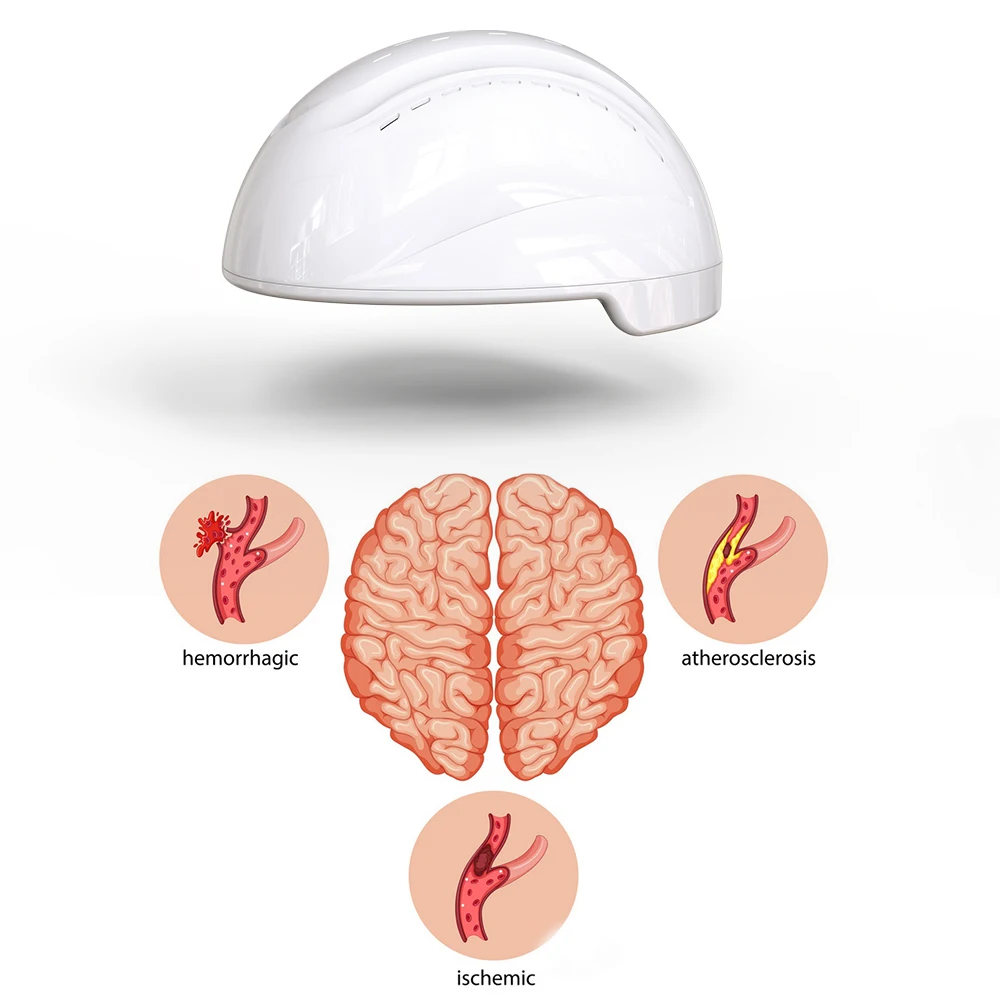 Photobiomodulation Brain Helmet Infrared Light Therapy Transcranial Brain Stimulation Neurofeedback Machine Parkinson Stroke