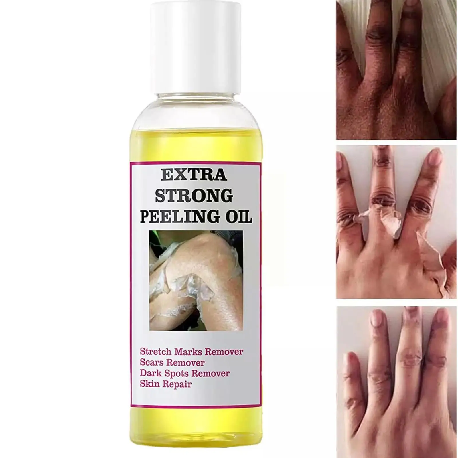 Óleo de Peeling para Pele Escura, Super Força, Amarelo, Forte, Clareamento, Hidratante, Remove De S8B0