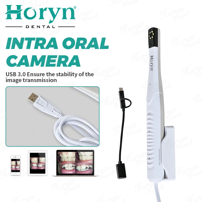 USB Intraoral den tal Endoscope cam era Real-time Intra Oral cam era den tistry Tooth