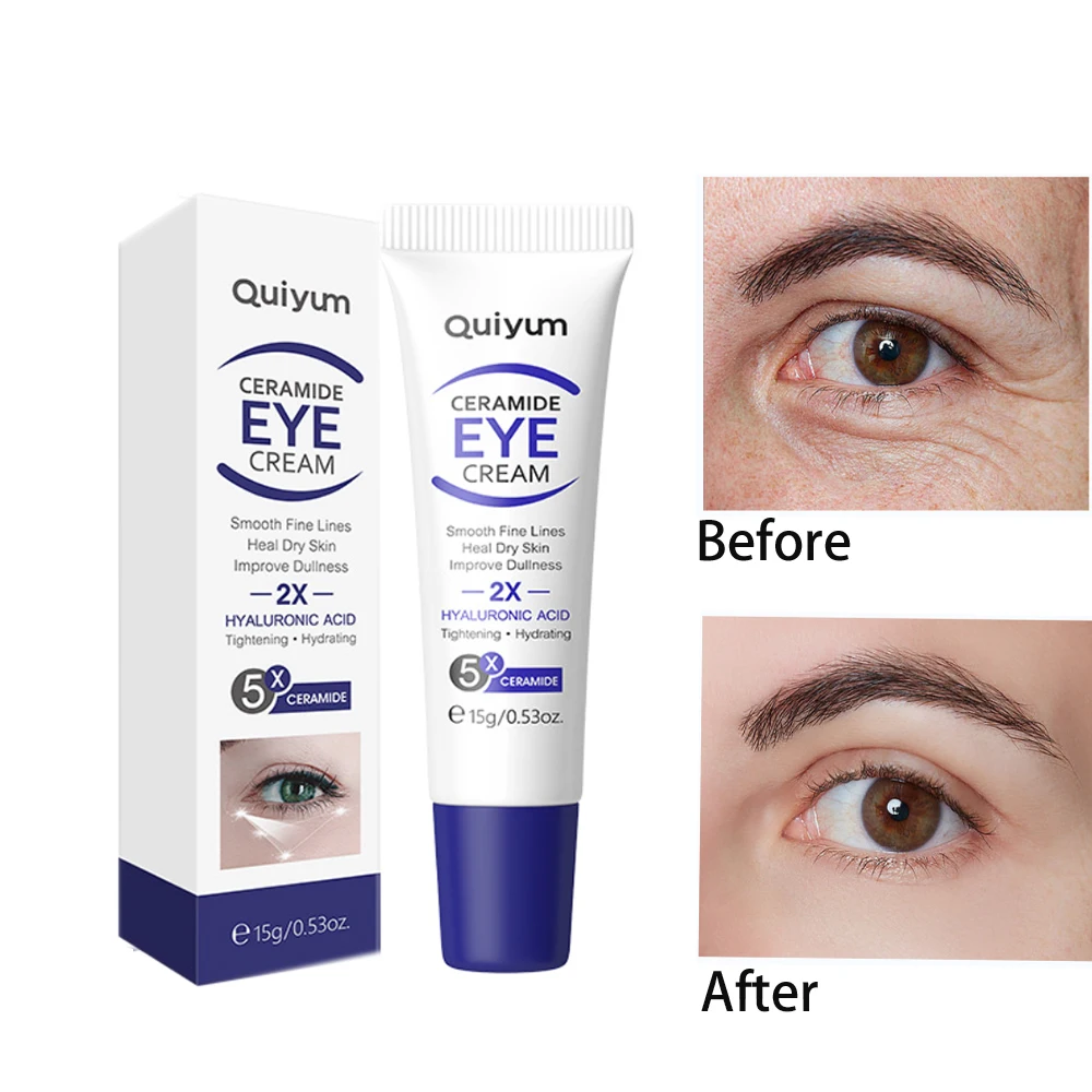 

Hyaluronic Acid Instant Firm Eye Cream Dark Circles Wrinkle Remover Crema Corrector De Ojeras Anti Aging Cernes Sous Les Yeux