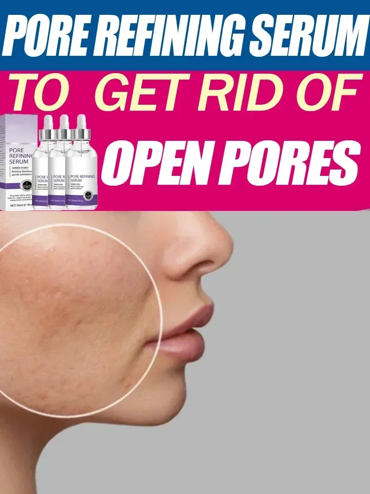 

Powerful Pore Shrinking Serum for Tightening and Removing Large Pores on The Face