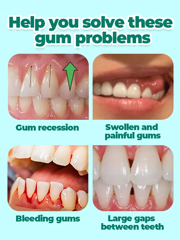 Gum Soothing Drops, repair gum recession, relieve gum bleeding and tooth pain