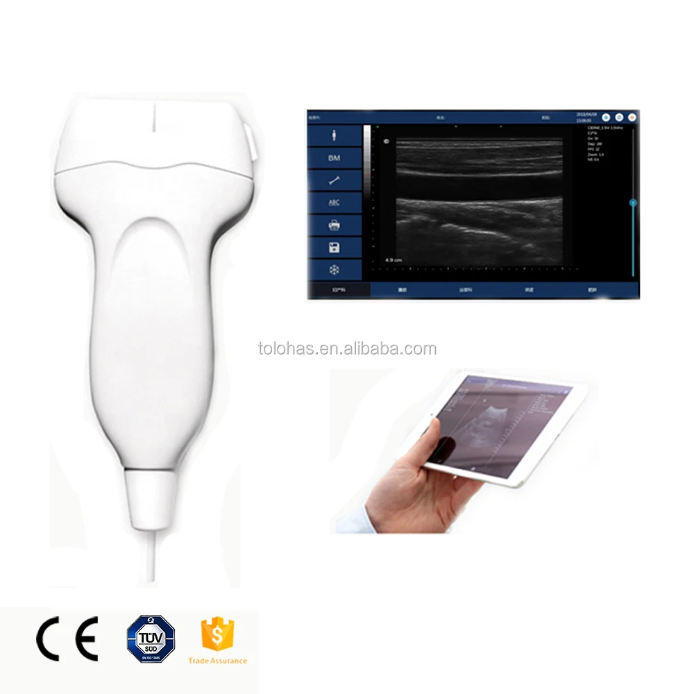 LHUP20L Medical USB Linear Ultrasound Probe /Portable Ultrasound Probe /Pocket Ultrasound Machine for Android Windows