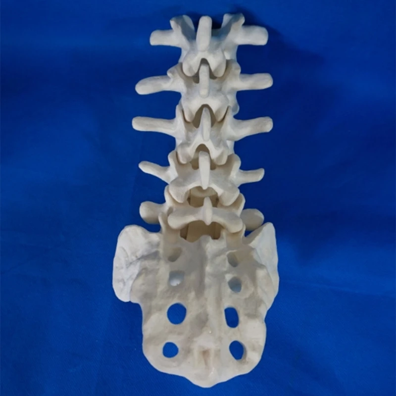 Human Lumbar Vertebrae Model with Sacrum Teaching Tool Lumbar Vertebrae Anatomically Model for Student Study Display Y3NC