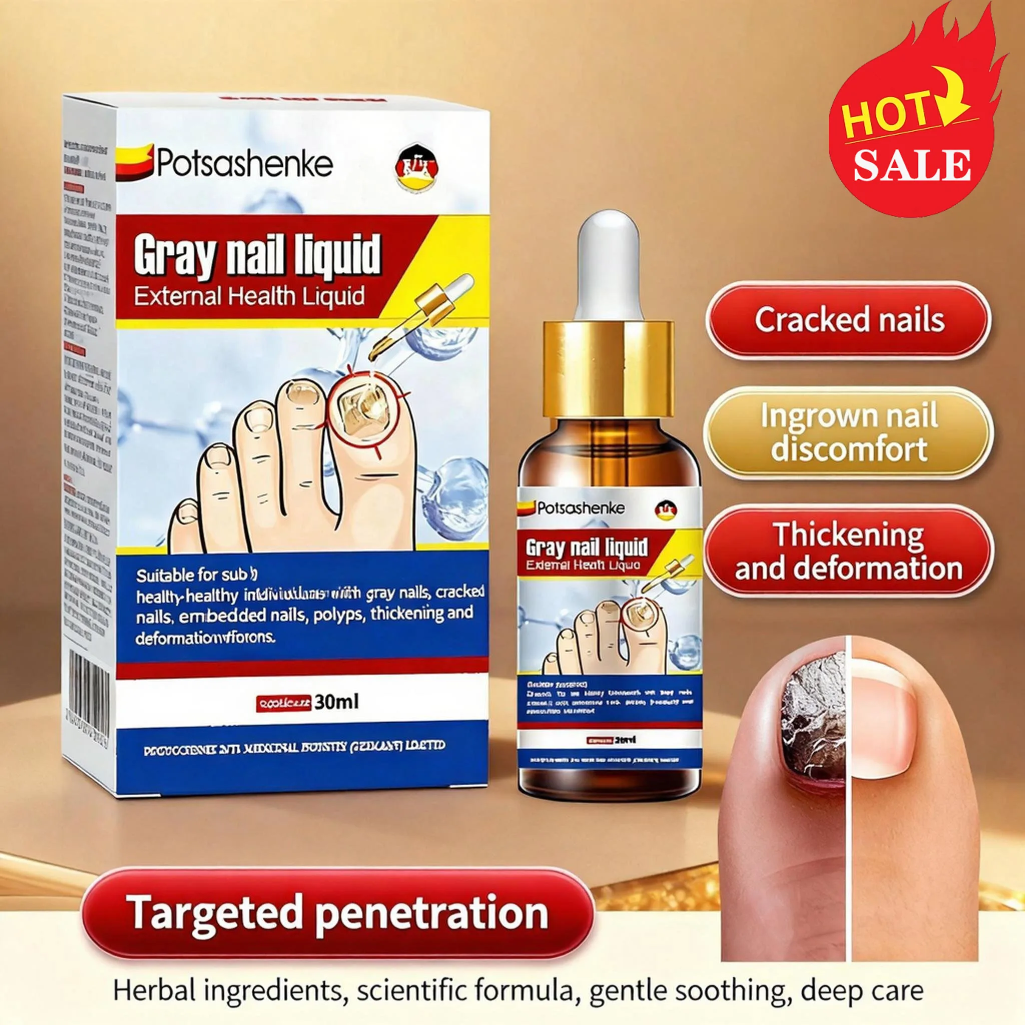سائل تعقيم فطريات الأظافر 30 مل - العناية بالأظافر فطار الأظافر يساعد على تحسين متشقق متغير اللون لأظافر القدم والأظافر