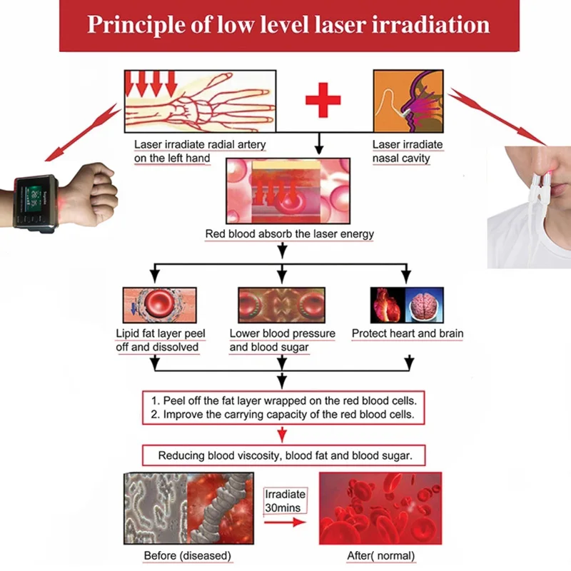 Cold Laser Therapy Watch for Diabetes Hypertension LLLT Device Medical Physiotherapy Medical Watch Treatment Diabetic Nerve Pain