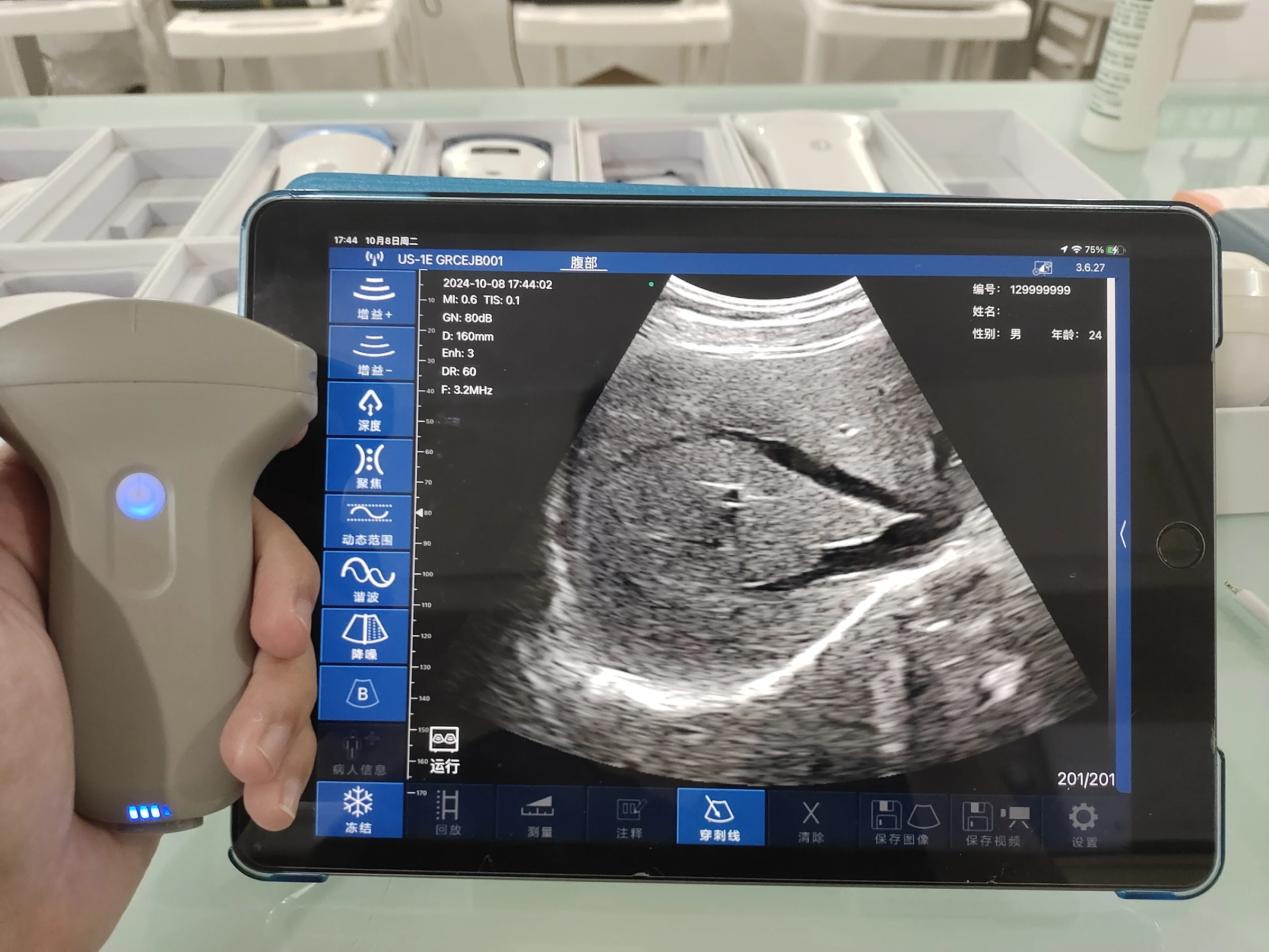 Hospitals High Quality Cheap Handheld Wireless Ultrasound Probe Color Doppler Scanner Portable Conve+Linear+Cardiac Probe