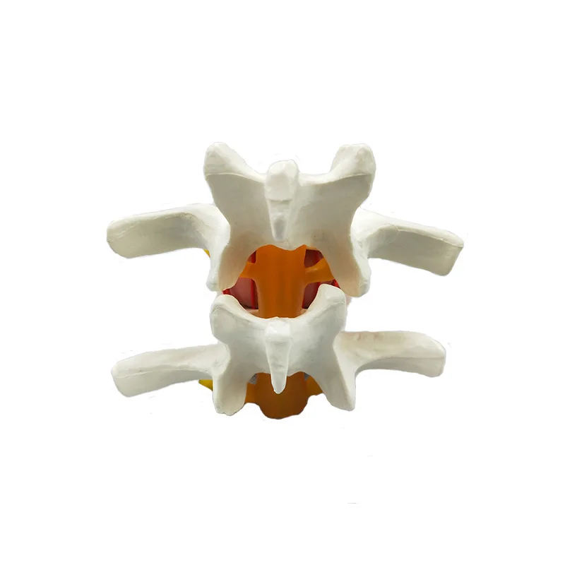 人体解剖学スケルトン脊椎腰椎椎間板ヘルニア椎骨変性マネキン椎間教育モデル