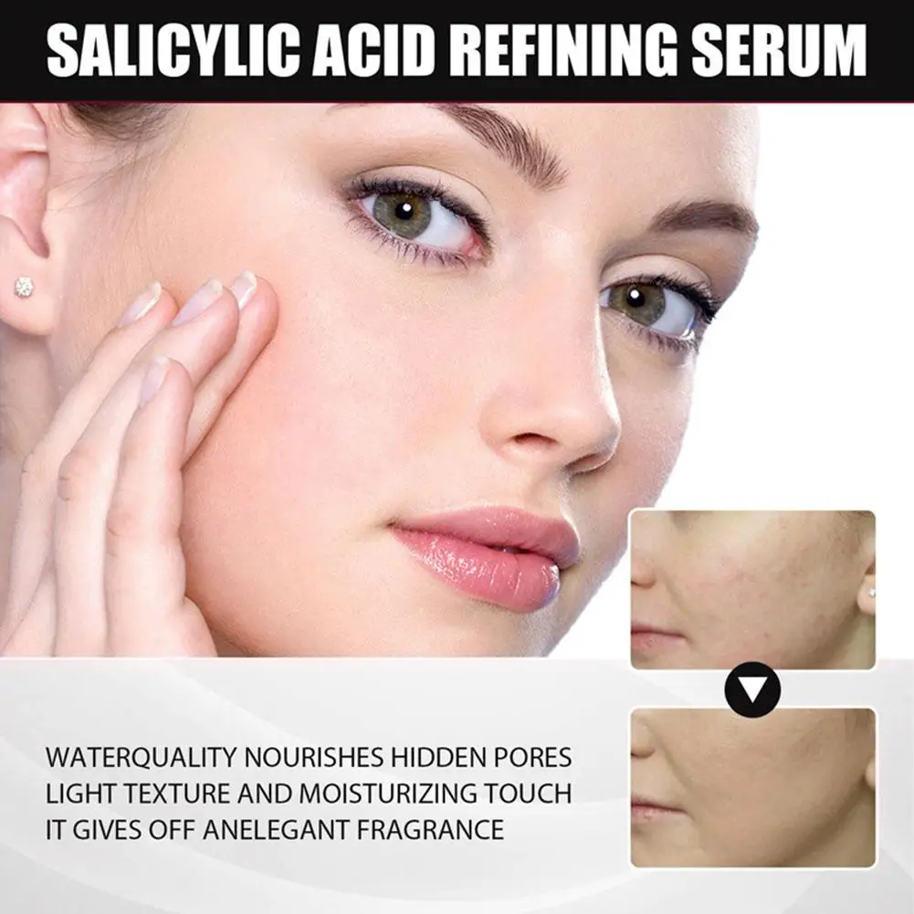 Salicylic Acid Delicate Pore Facial Essence Hydrating Acne Face Moisturizing Gentle Pore Shrinking Care Marks Reduces Serum U5V7