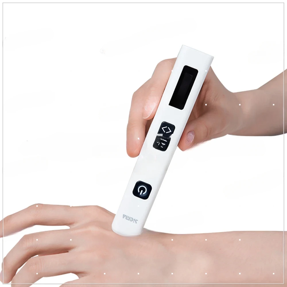 SIGMA Wand Ace 308nm excimer   UVB phototherapy device UV light lamp for vitiligo psoriasis