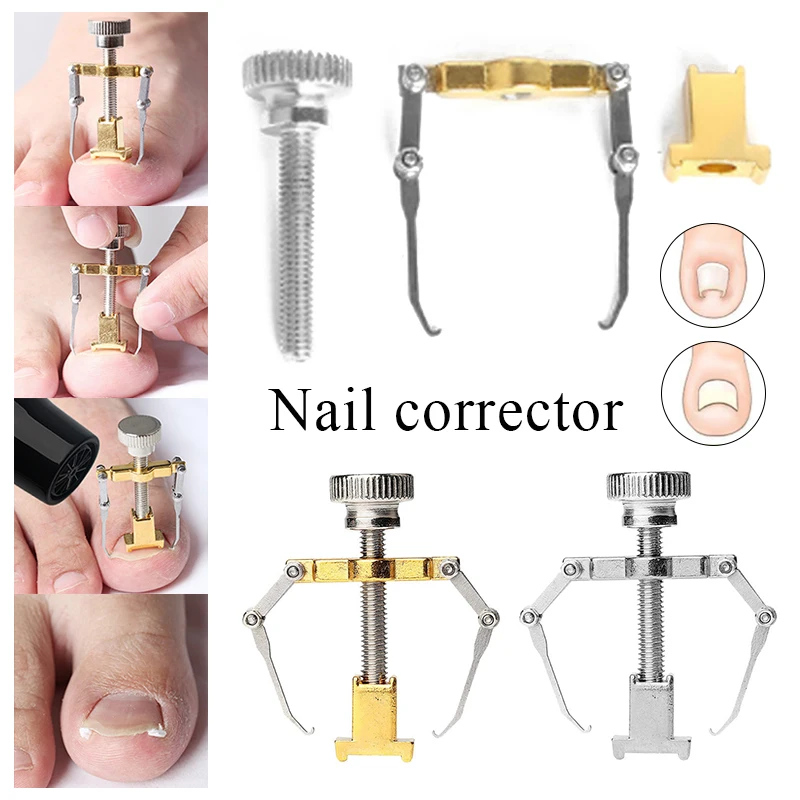 Nail Straighten Clip Ingrown Pedicure Tool Toenail Corrector Clip Cure Ingrown Toenails Health Care Relief Pain Stainless Steel