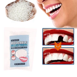 Kit de reparación temporal de dientes de resina, pegamento sólido para dentadura postiza, 25g, blanqueamiento dental, Belleza