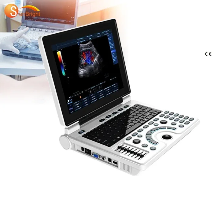 cheap PC medical scan system portable ultrasound machine in hospital clinic echo USG