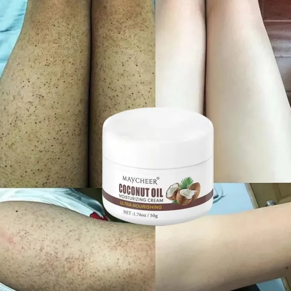 50g Keratosis Pilaris Repair Cream Chicken Follicle Skin Remove Body Dark Spot Smooth Body Lotion Moisturiz Whitening Dull Skin