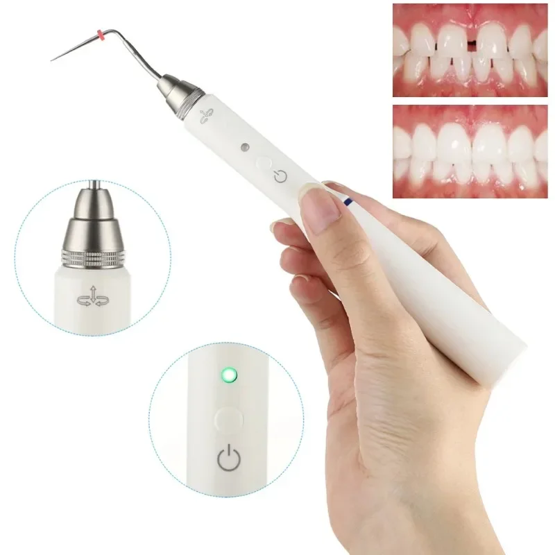 Wireless Root Closure System Heating Pen Root Closure Endo Wireless Dolby Teeth Whitening Tools + 2 Tips