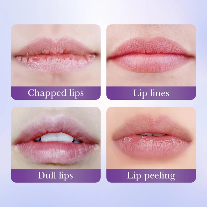 BIOAQUA الريتينول كريستال الكولاجين قناع الشفاه ترطيب طبطب الشفاه أقنعة هلامية المضادة للتجاعيد ترطيب الشفاه سمنة الشفاه العناية بالبشرة #6