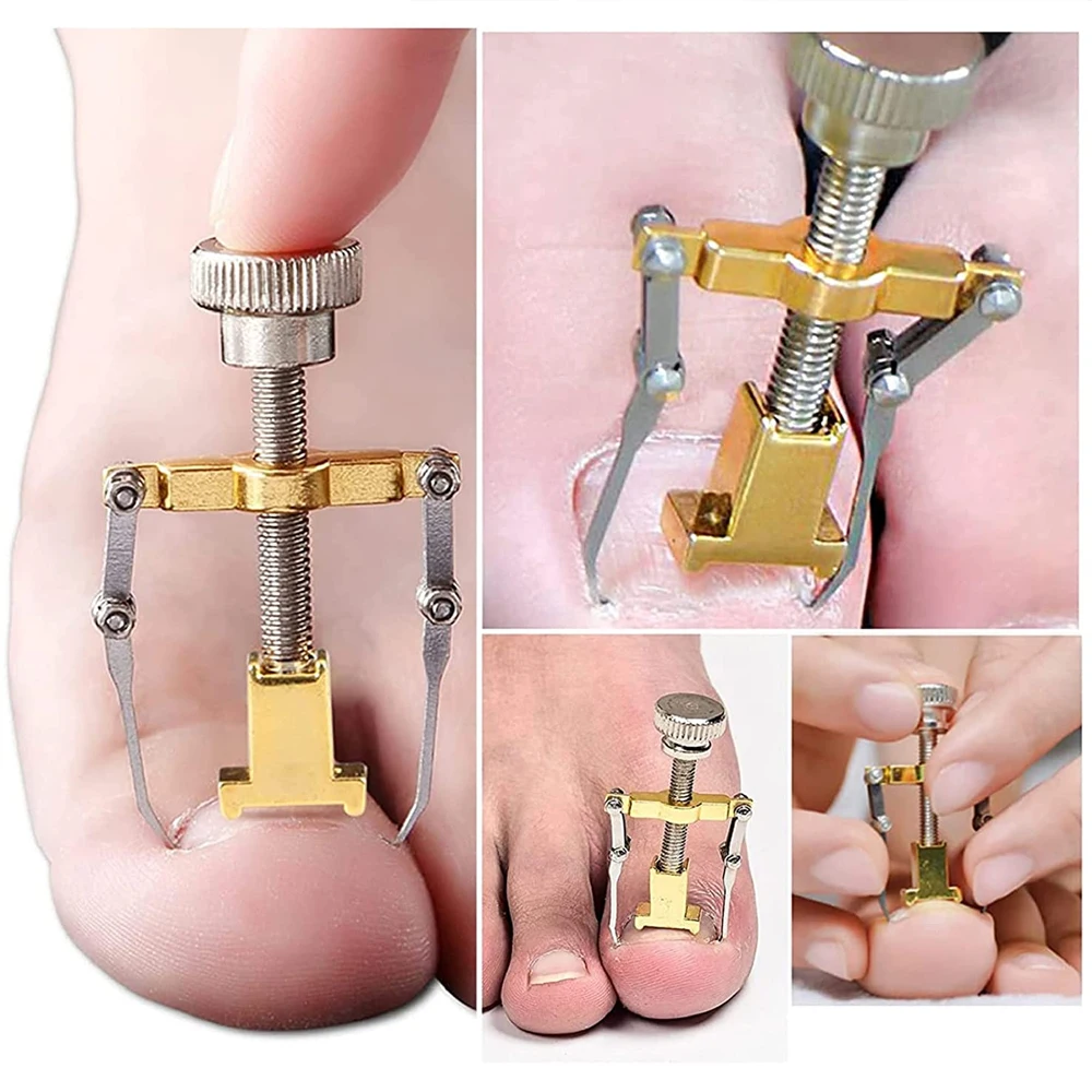 Ingrown Toenail Tools Set Ingrown Toenail Correction Patch Stickers Corrector Pedicure Tool Ingrown Toe Nail Treatment Foot Care