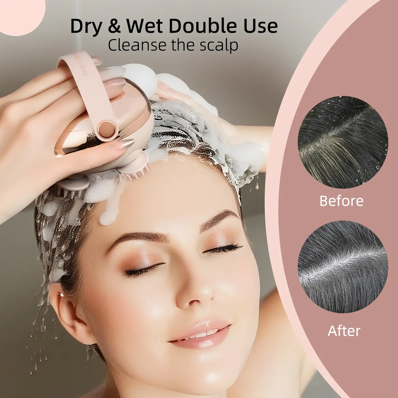 

Jinkairui Многофункциональный массажер для головы, декомпрессионный акупунктурный массажер для кожи головы, меридиан, красный свет, портативный массажер для домашних животных