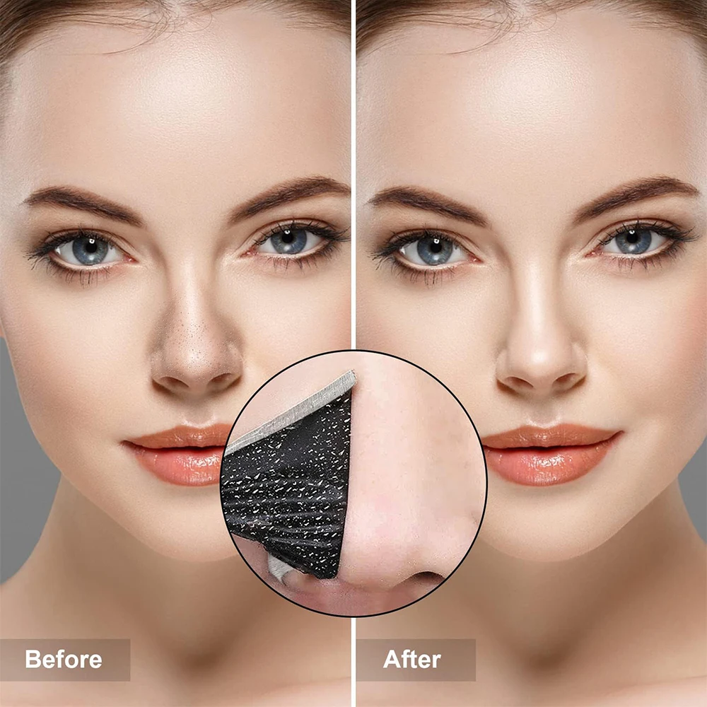 Mascarilla para eliminar espinillas, tiras nasales, limpieza profunda del poro, nariz, cabeza negra, pegatinas para quitar, parche para mascarilla para el cuidado de la piel Unisex