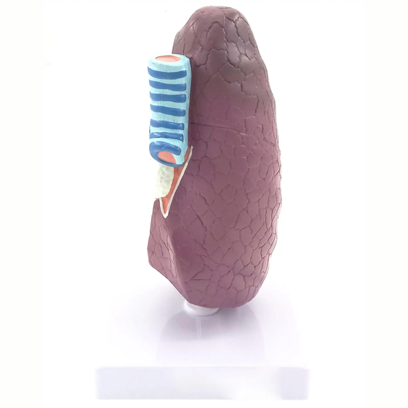 PVC Diseased Lung Medical Model Pulmonary Anatomy Respiratory System for Patient Education