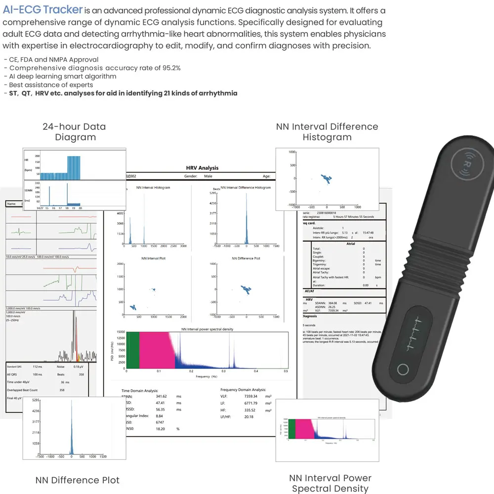 AI Dynamic ECG,Wearable Holter ECG EKG,24h Real-time Dynamic ECG Monitor,AI Analysis,With Bluetooth function