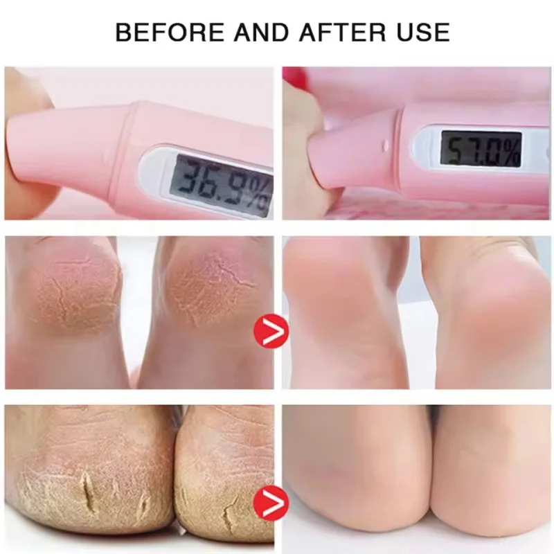 Herbal Anti Crack Foot Cream Spray Heel Cracking Repair Products Exfoliation Dead Skin Removal Softening Moisturize Smooth Care