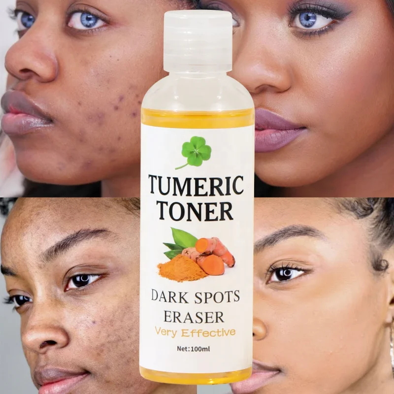 Turmeric Toner Dark Spots Eraser Brightening Skin Even Skin Tone Fades Blemishes Acne Remove Whitening Face Toner