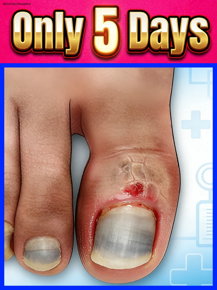 

Sᴀʏ ɢᴏᴏᴅʙʏᴇ ᴛᴏ ᴅᴀᴍᴀɢᴇᴅ ɴᴀɪʟs, ʀᴇɴᴇᴡ ᴛᴇxᴛᴜʀᴇ ғᴏʀ sᴍᴏᴏᴛʜ ᴘᴇʀғᴇᴄᴛɪᴏɴ.