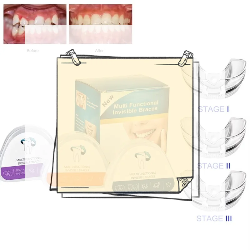 Braces Dental Braces Smile Teeth Alignment Trainer Instanted Silicone Teeth Retainer Mouth Guard Braces Tooth Tray