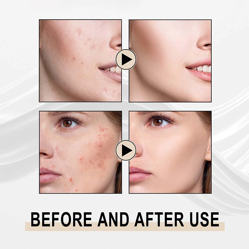 Lactobionic Acid Serum Shrink Pores Moisturizing Essence Liquid Facial  Purify Pore Treatment Beauty whitening cream Skin Care